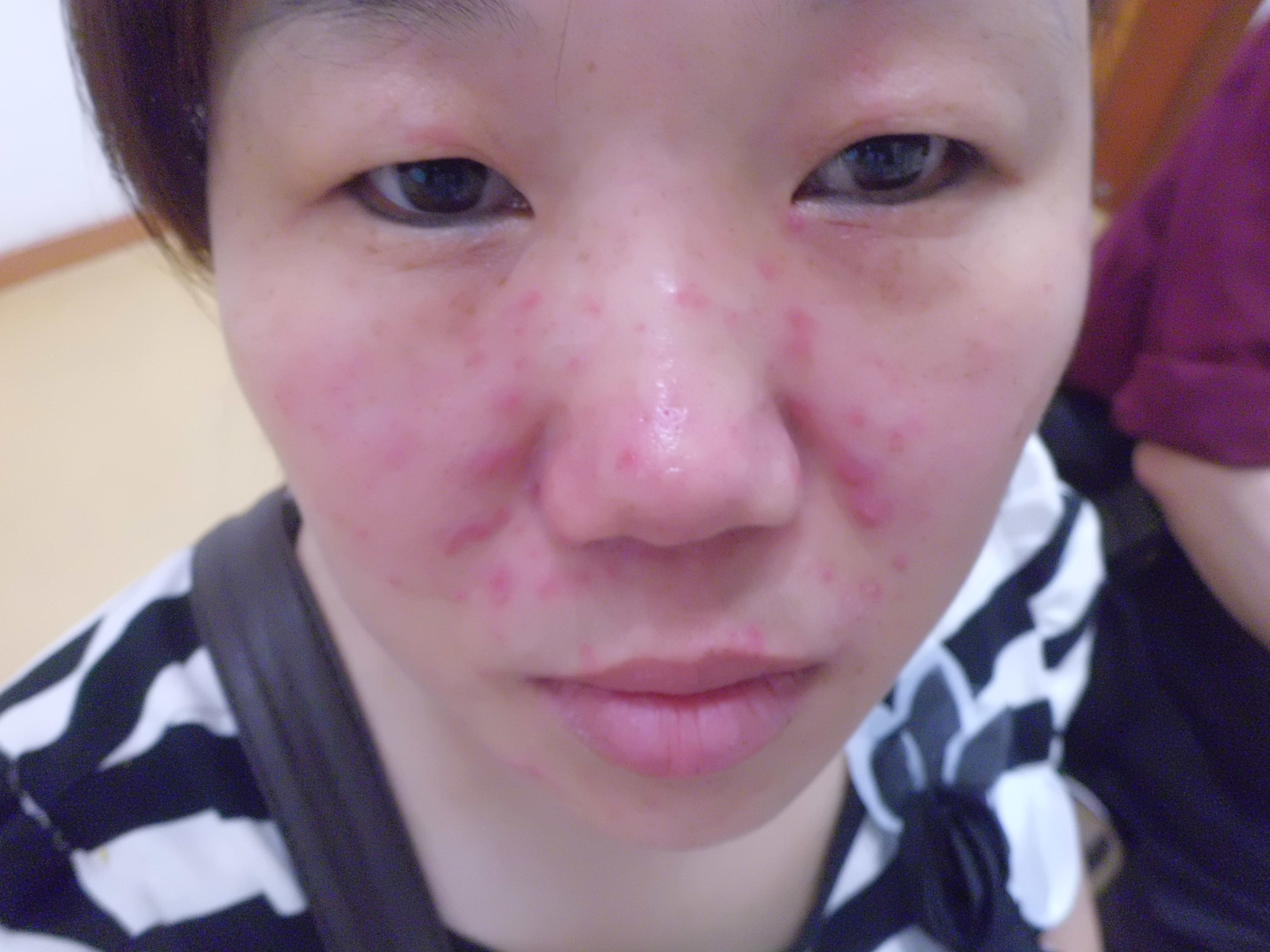 患者正在接受治疗