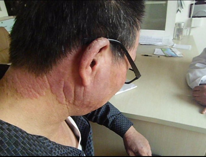 患者症状