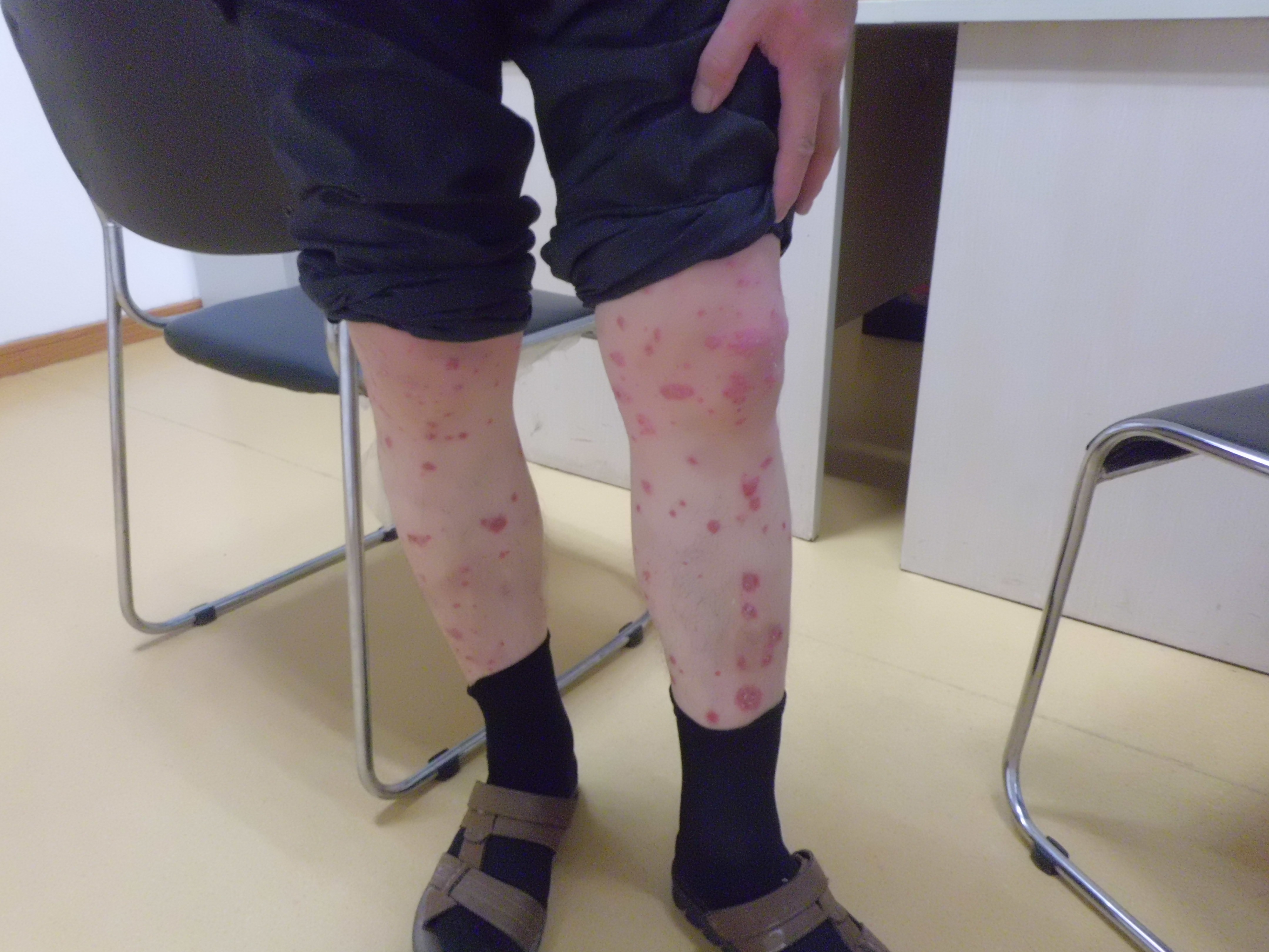 患者症状